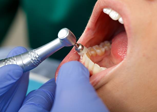 Best Dental Fillings (Composite and Amalgam)  in Gonzales, LA